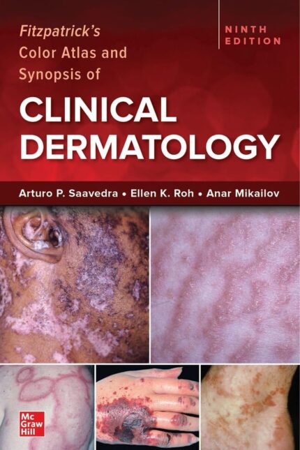 Fitzpatrick's Color Atlas and Synopsis of Clinical Dermatology (9th Edition) – eBook PDF